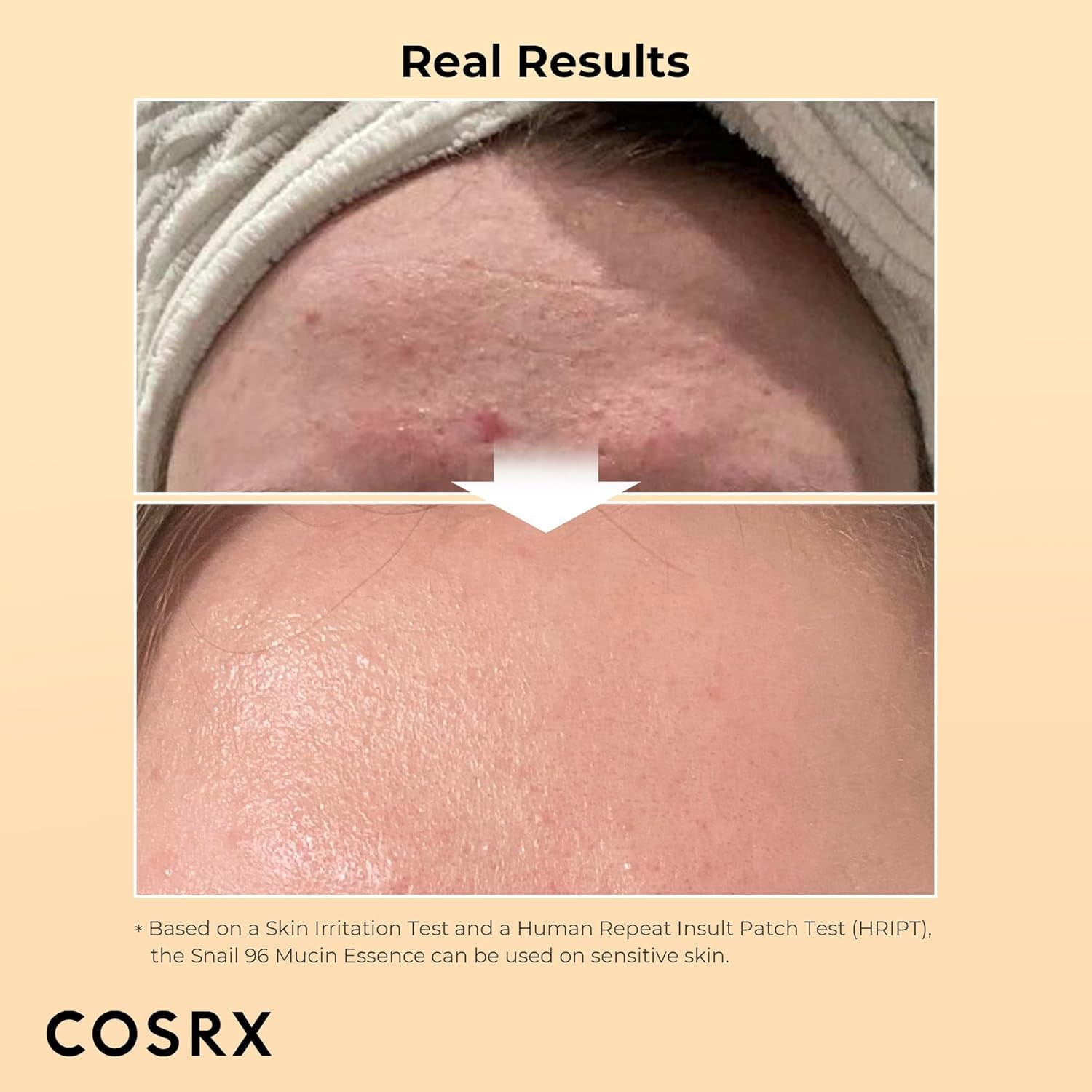 COSRX Snail Mucin 96% Power Repairing Essence 3.38 Fl.Oz 100Ml, Hydrating Serum for Face with Snail Secretion Filtrate for Dull Skin & Fine Lines, Korean Skin Care