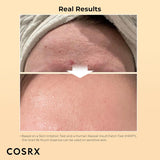 COSRX Snail Mucin 96% Power Repairing Essence 3.38 Fl.Oz 100Ml, Hydrating Serum for Face with Snail Secretion Filtrate for Dull Skin & Fine Lines, Korean Skin Care